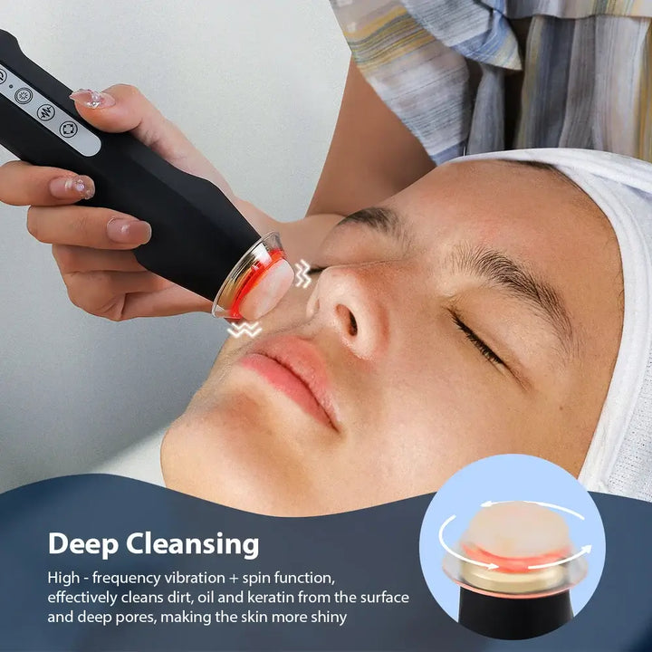 Woman receiving facial treatment with an oxygen bubble pen for deep cleansing and skin rejuvenation.