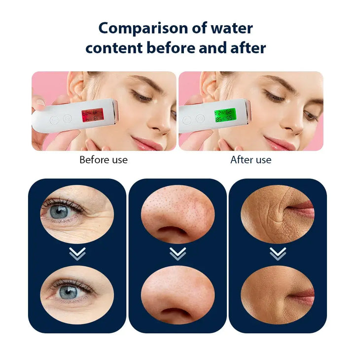 Facial skin moisture levels comparison before and after using CO2 Oxygen Portable Facial Machine in a skincare routine.